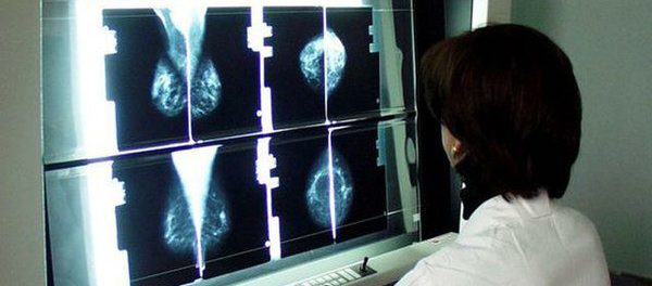 screening - siracusatimes