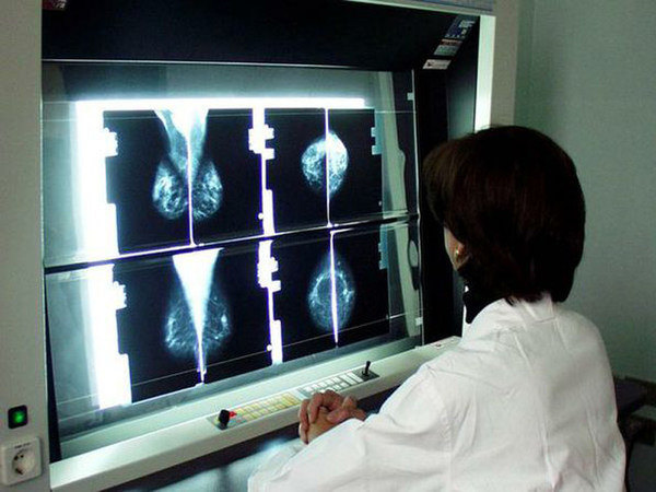 Screening oncologici di Asp Siracusa: giornate informative per i dipendenti comunali di Augusta