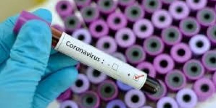 Coronavirus, laboratori analisi nel siracusano per l’analisi dei tamponi