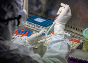 Siracusa. Il Tocilizumab produce miglioramenti in altri 8 pazienti affetti da Covid19