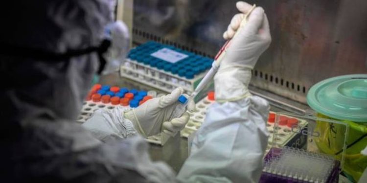 Siracusa. Il Tocilizumab produce miglioramenti in altri 8 pazienti affetti da Covid19