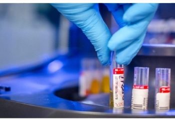 Coronavirus, in Sicilia attivi 20 laboratori per i tamponi