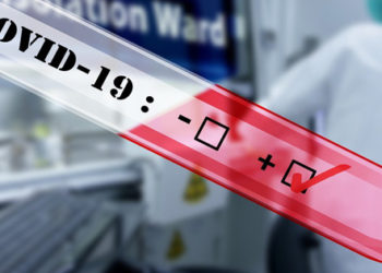 Coronavirus in Sicilia, ecco a chi è rivolto il test sierologico