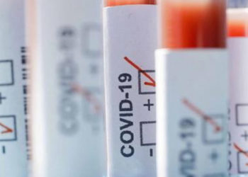 Coronavirus, dal Comitato Scientifico Sicilia: “Sì ai test rapidi e sierologica”