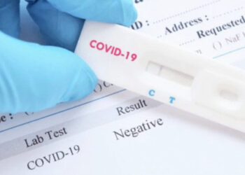 Test sierologici, Razza: risultati utili, i siciliani rispondano all’appello”