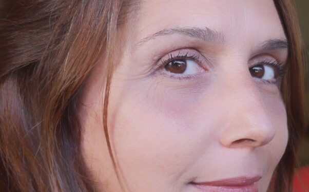 Siracusa. Fratelli d’Italia: “ripristinare subito il trasporto pubblico e il parcheggio di via Elorina”