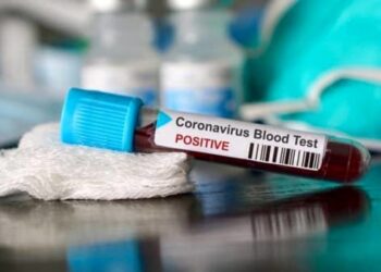 Canicattini Bagni. Salgono a due i casi di positività al Covid-19
